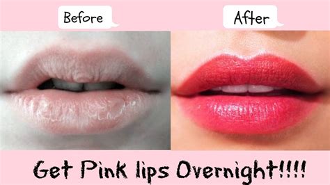 res lips|How to Make Lips Pink Naturally, Forever, Red, Overnight.